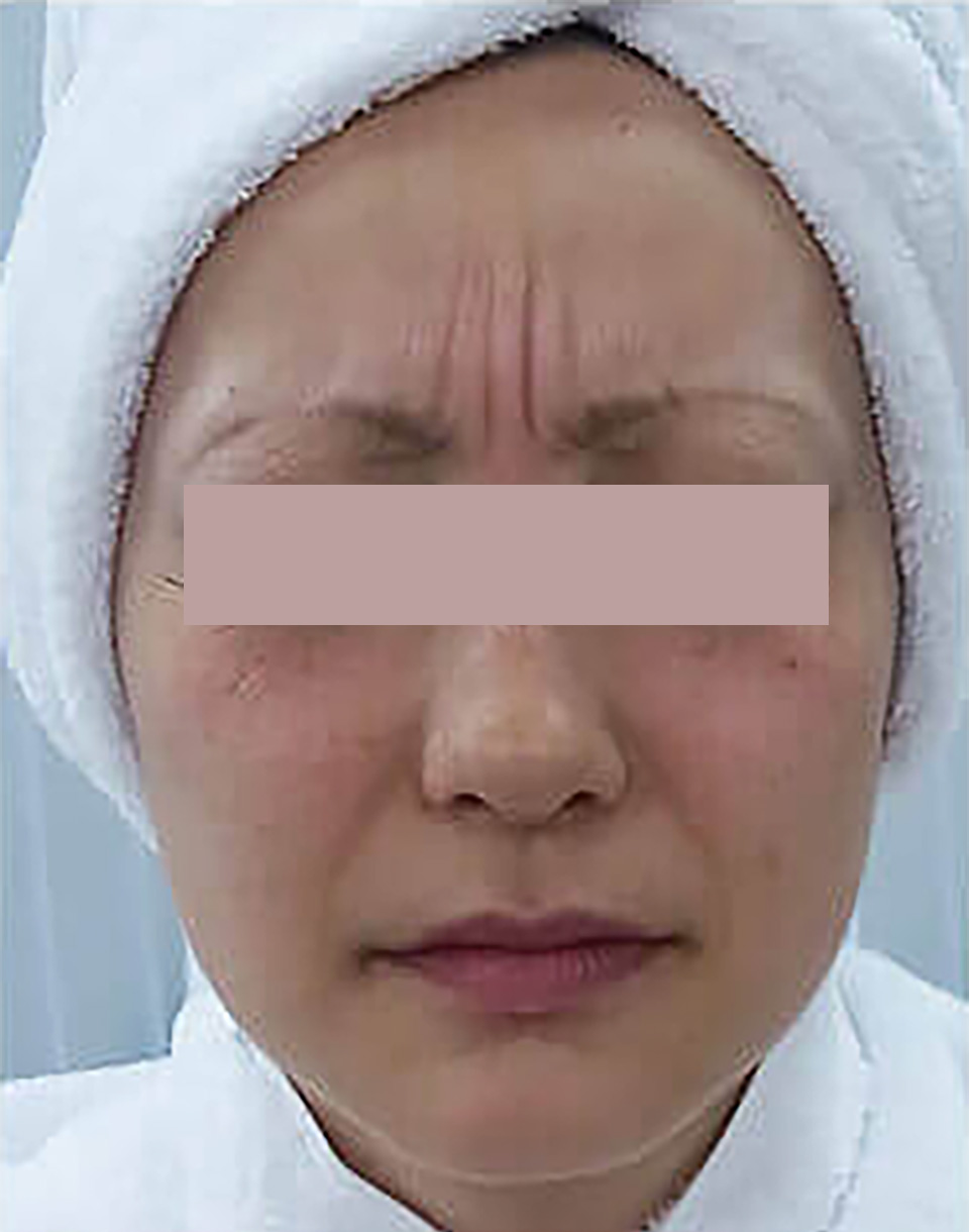 Before
