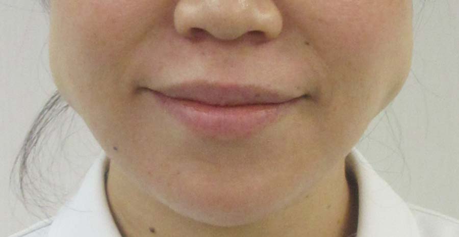 Before