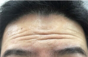 Before