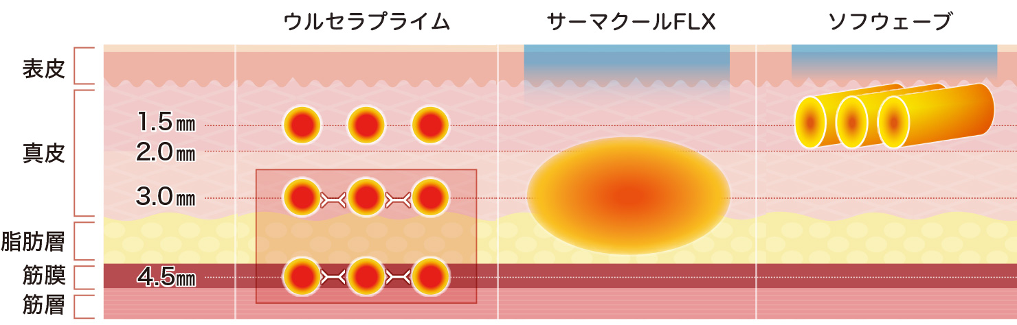 あなたに最適なのはどれ？「三種の神器」比較まとめ