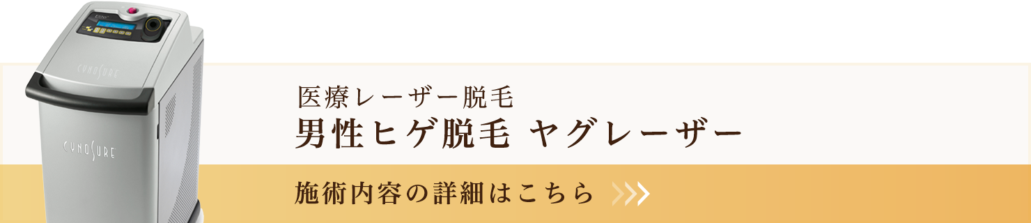 男性ヒゲ脱毛 ヤグレーザー