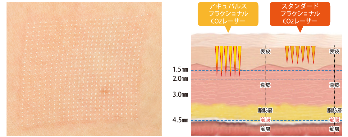 フラクショナル史上最も細かく幅広い設定