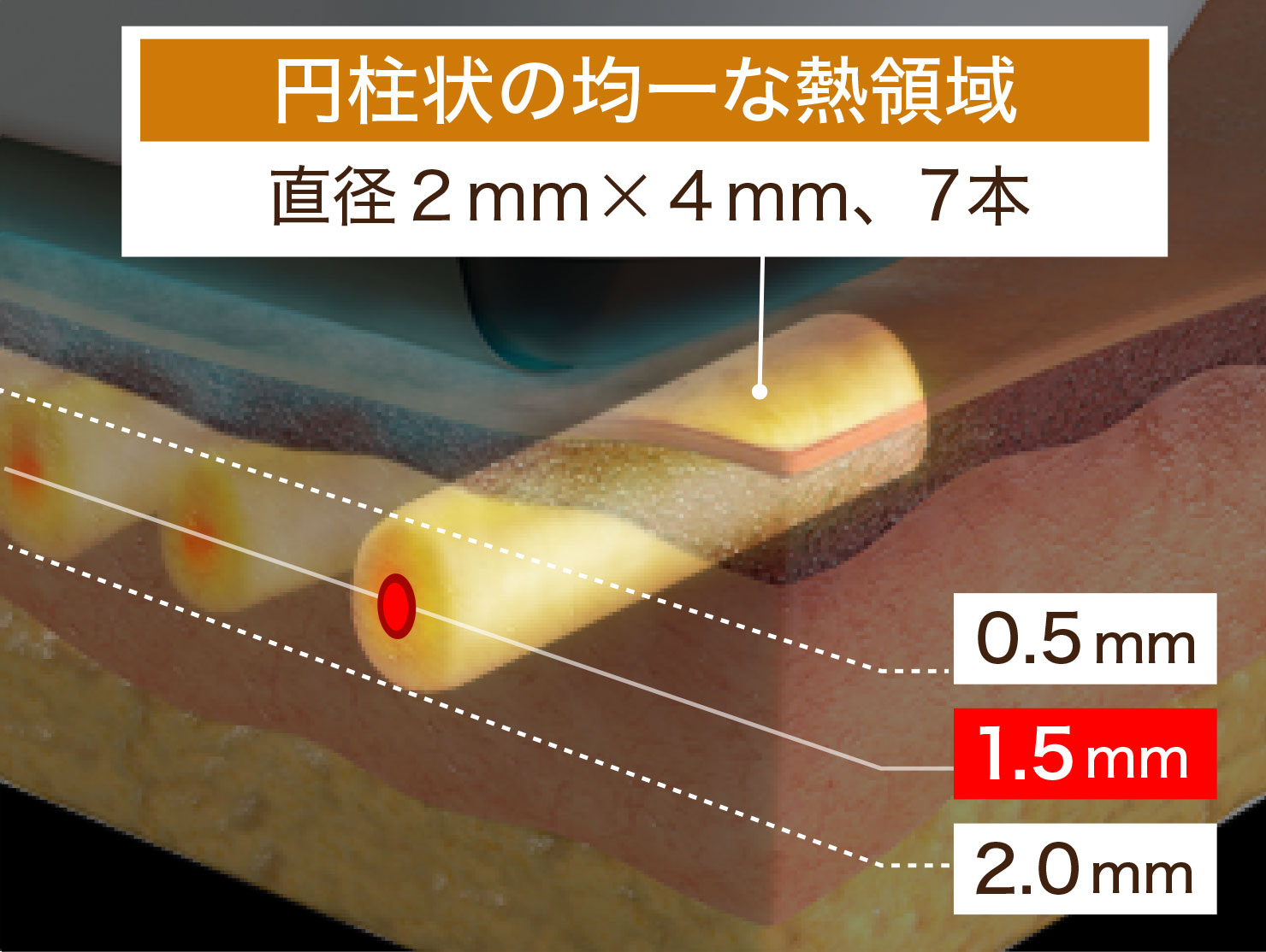 円柱状の均一な熱領域