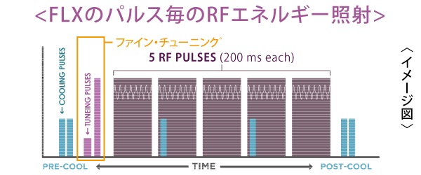 サーマクールFLXは効率の良い自動設定にて照射してくれます。