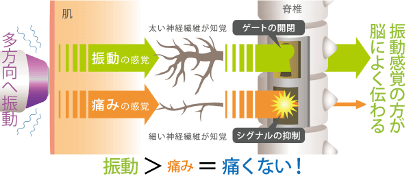 サーマクールFLXではゲートコントロール理論で熱感を緩和します。