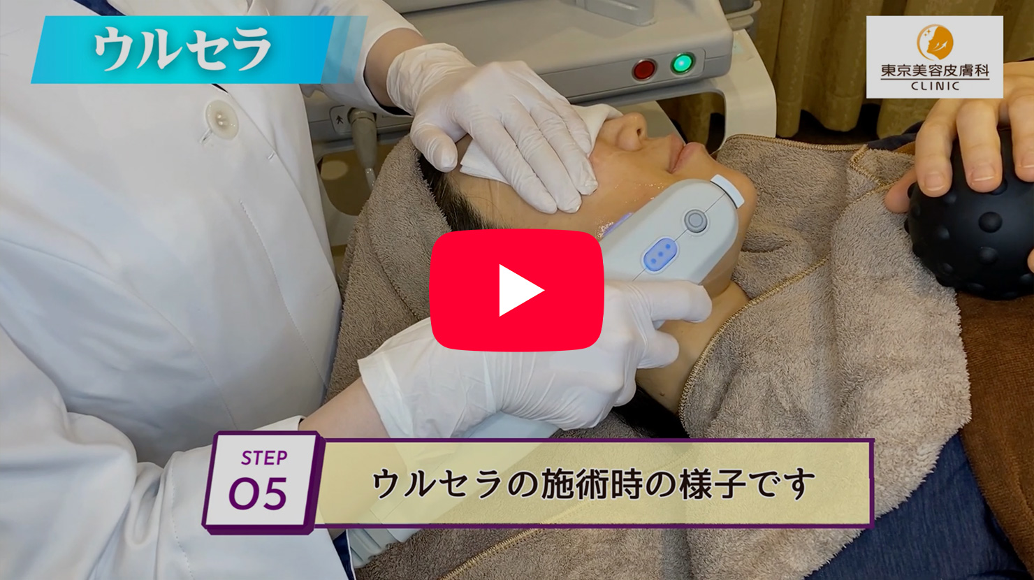 当院でのウルセラの施術