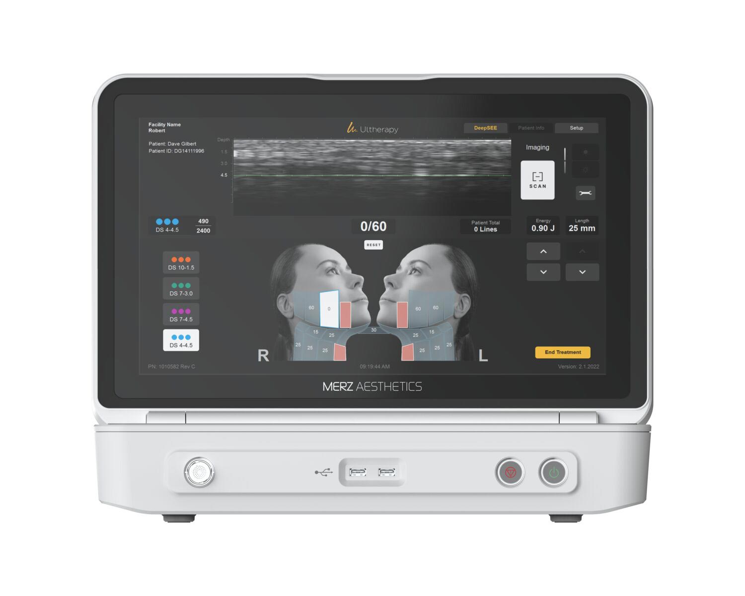 高解像度の超音波可視化