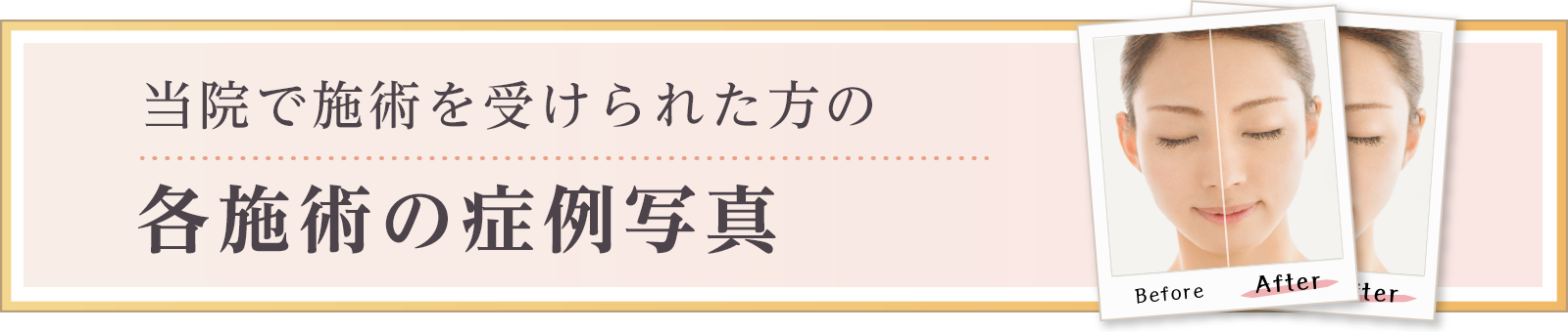 各施術の症例写真