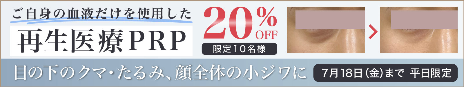 再生医療PRPキャンペーン