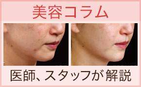 美容コラム　医師・スタッフが解説