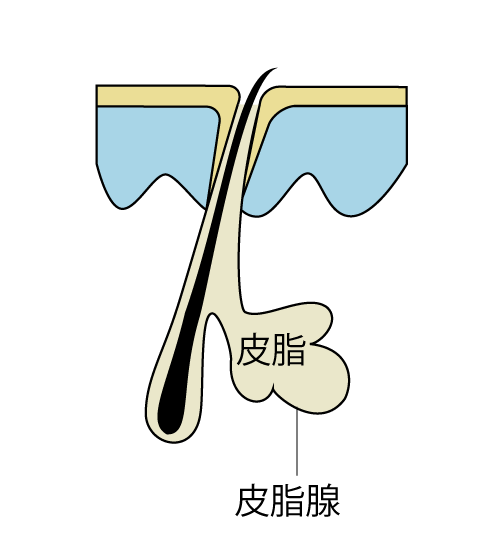 老人性色素斑