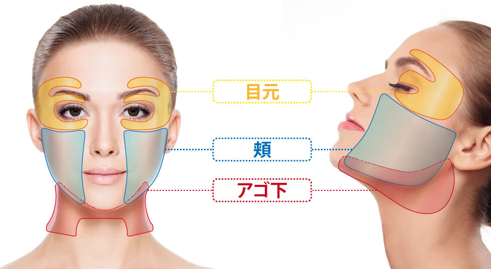 エンディメッドプロ 東京美容皮膚科クリニック 港区浜松町駅