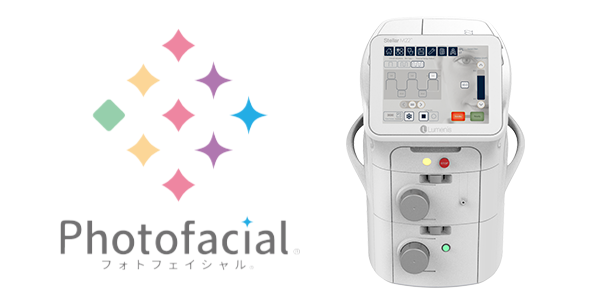 ステラM22（IPL）フォトフェイシャル