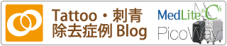 東京美容皮膚科クリニック公式タトゥー除去ブログ